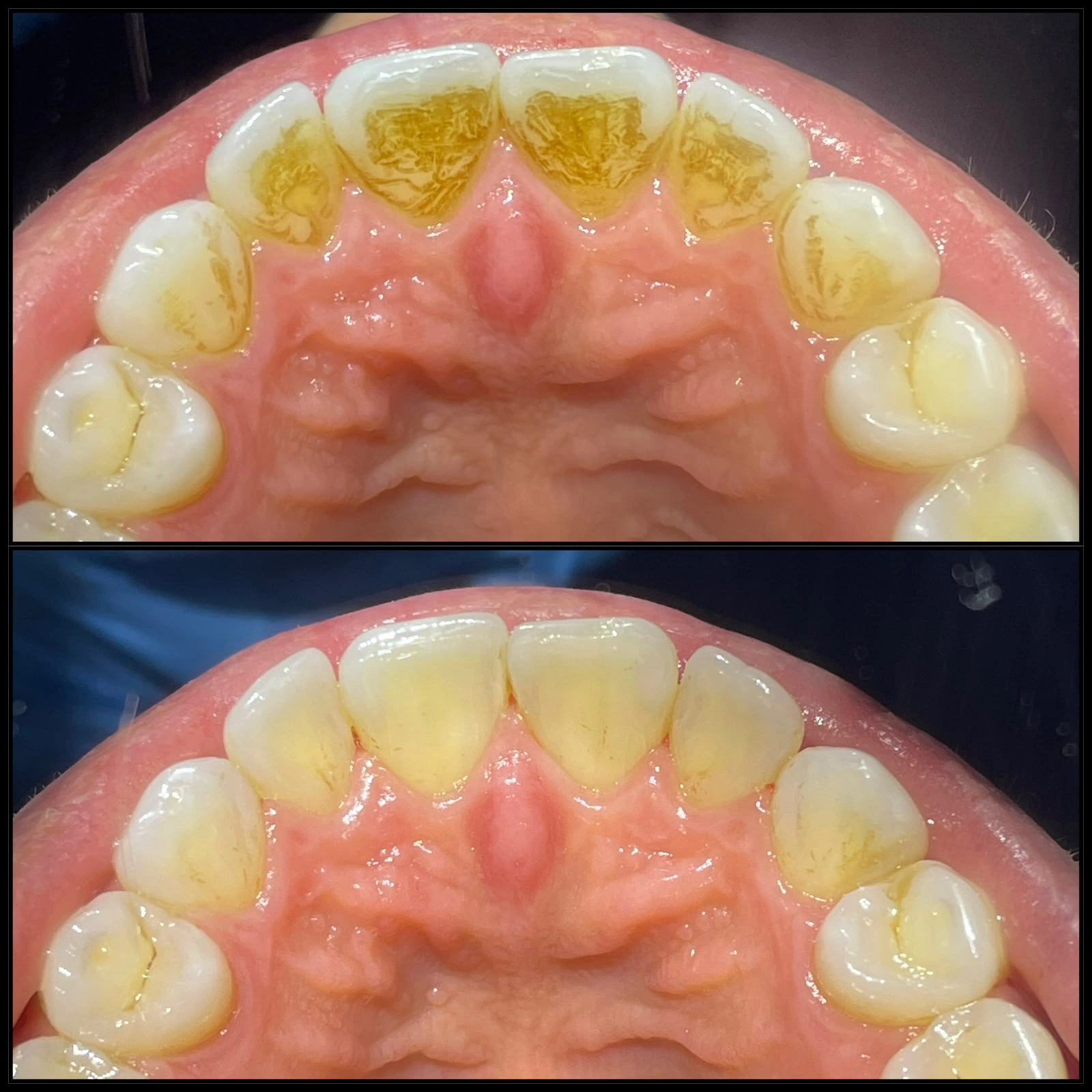 Limpeza Dental — imagem fornecida
