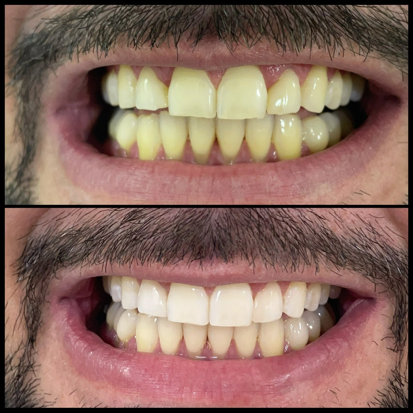 Clareamento Dental — imagem fornecida