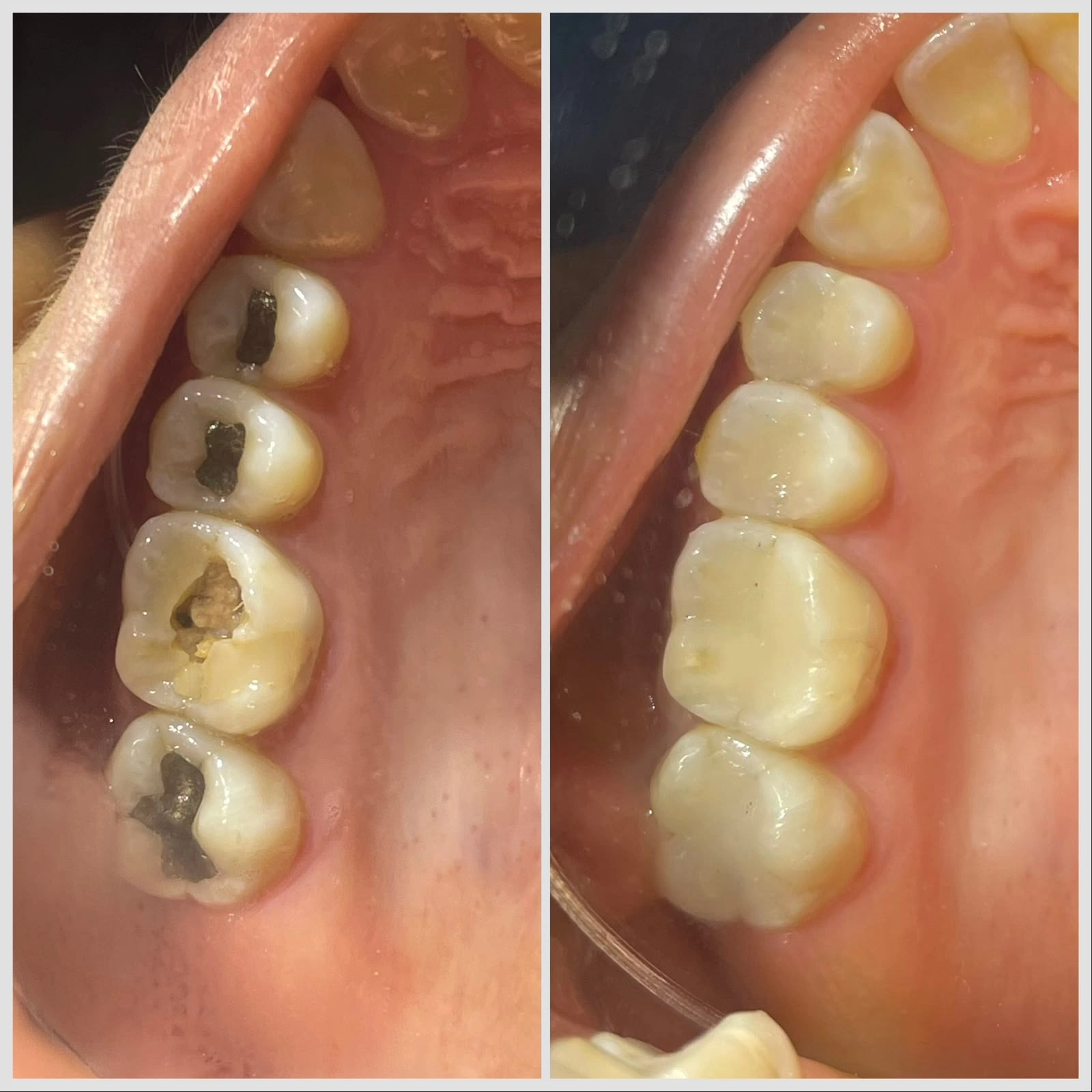 Restauração Dental — imagem fornecida