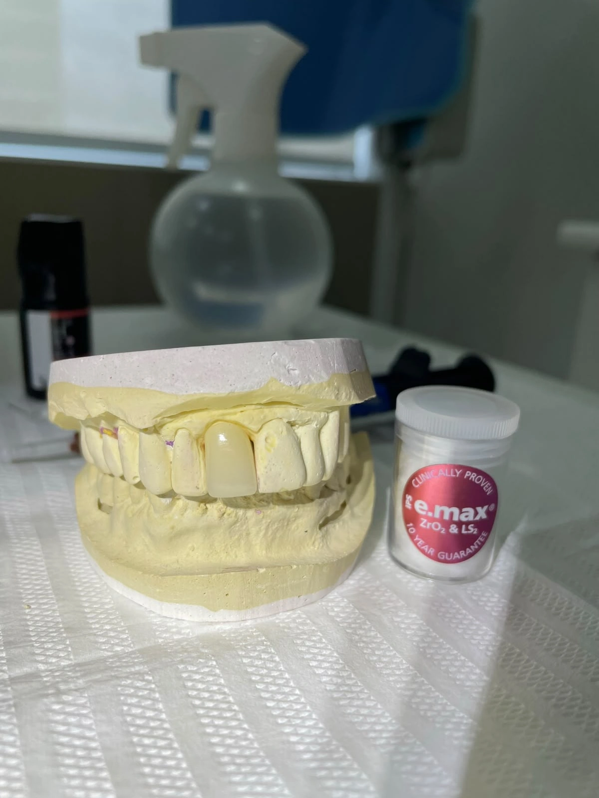 Coroas e Próteses Dentárias — imagem fornecida